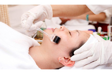 1001 lí do nên trị sẹo lõm sẹo rỗ bằng Nano Basic!