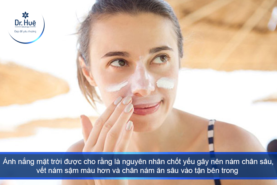 ánh nắng mặt trời là nguyên nhân chủ yếu gây nên nám 