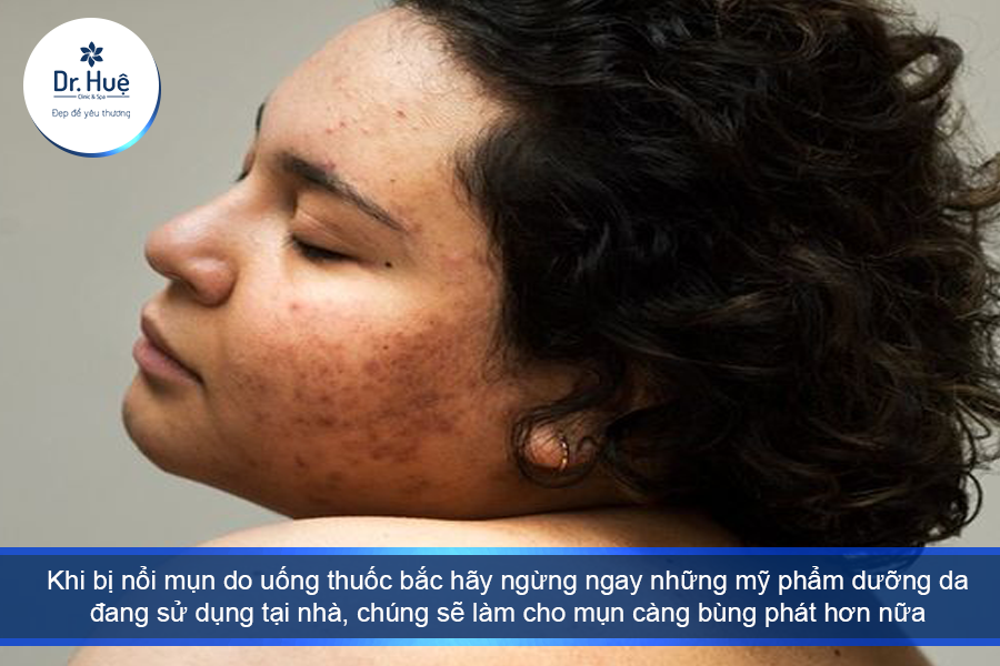 Ngưng sử dụng các sản phẩm dưỡng da tại nhà