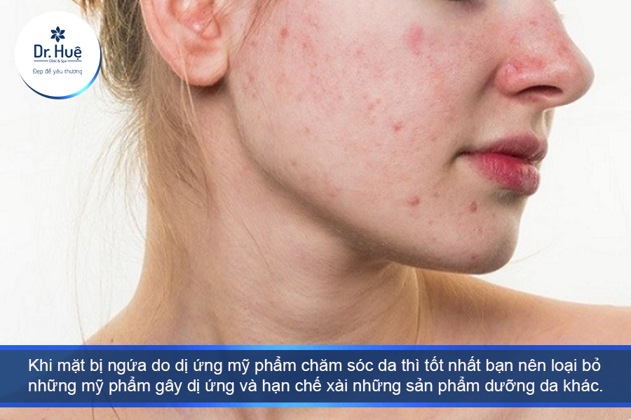 Ngừng sử dụng những mỹ phẩm gây kích ứng 