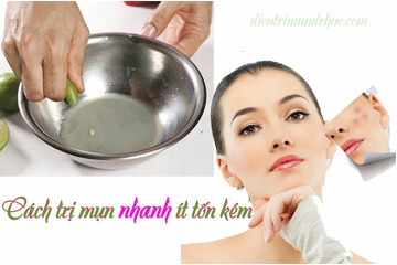 3 Cách trị mụn nhanh và ít tốn kém nhất