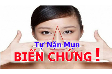 Bạn đã biết đến những biến chứng không thể ngờ từ việc nặn mụn tại nhà chưa?