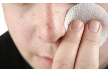 Bạn muốn biết thời điểm nào mụn bọc phát triển?