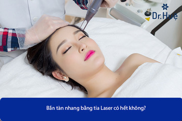 Bắn Tàn Nhang Bằng Tia Laser Có Hết Không