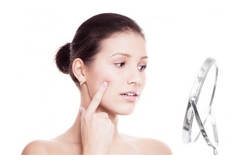 Bí quyết điều trị mụn trứng cá hiệu quả