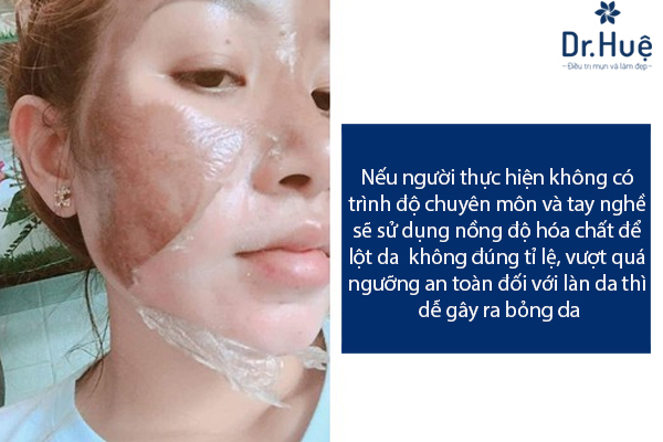 Các Biến Chứng Sau Khi Lột Da Sinh Học Trị Mụn Không Đúng Nơi Uy Tín