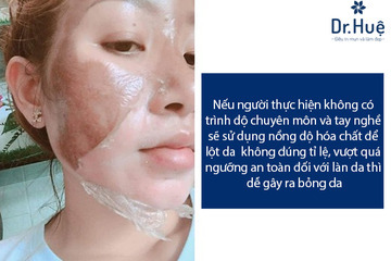 Các Biến Chứng Sau Khi Lột Da Sinh Học Trị Mụn Không Đúng Nơi Uy Tín