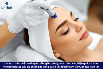 Cách chăm sóc da sau khi bắn laser trị nám tàn nhang