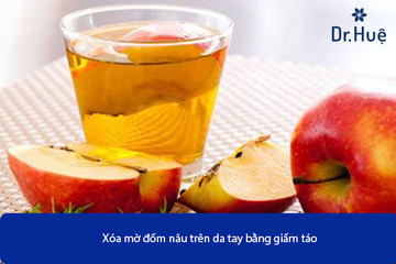 Cách Chữa Đốm Nâu Trên Da Tay Hiệu Quả An Toàn