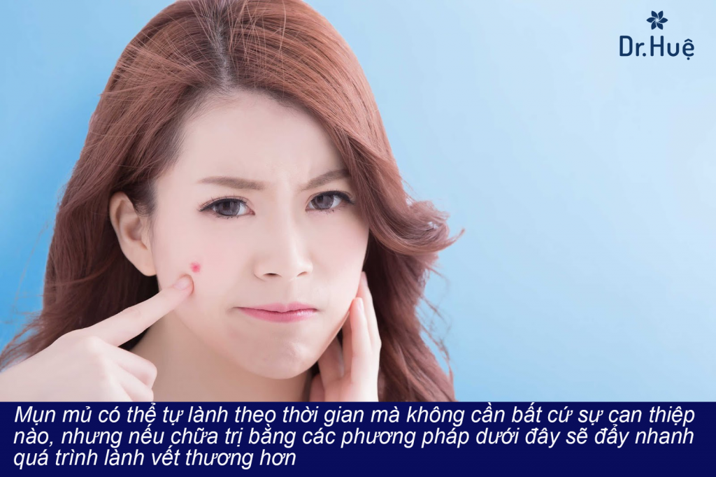 Cách chữa trị viêm da mặt nổi mụn mủ