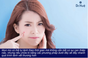 Cách chữa trị viêm da mặt nổi mụn mủ