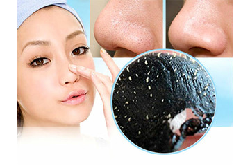 Cách điều trị mụn đầu đen tận gốc đơn giản nhất