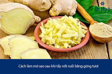 Cách Làm Mờ Sẹo Sau Khi Tẩy Nốt Ruồi