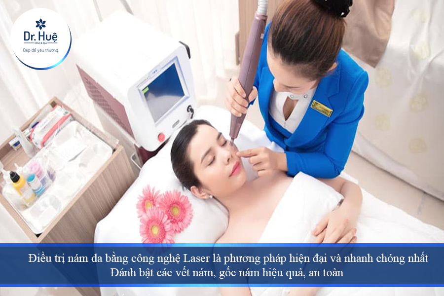 Điều trị nám bằng laser 