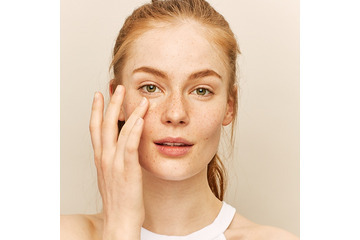 Cách phân biệt tàn nhang đồi mồi - Giống hay khác nhau không