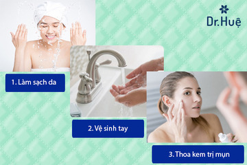 Cách Thoa Kem Trị Mụn Đúng Cách - Nên Bôi Kem Trị Mụn Vào Lúc Nào Là Tốt