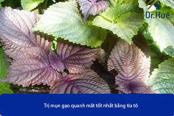 Cách Trị Mụn Gạo Quanh Mắt Hiệu Quả Nhanh