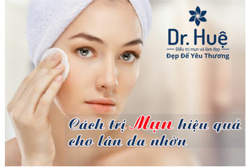 Cách trị mụn hiệu quả cho làn da nhờn