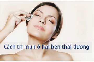 Cách trị mụn ở hai bên thái dương