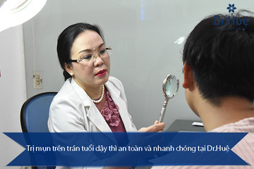 Cách Trị Mụn Trên Trán Tuổi Dậy Thì An Toàn Tại Dr. Huệ