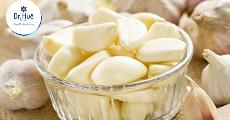 Cách trị mụn viêm bằng tỏi tại nhà