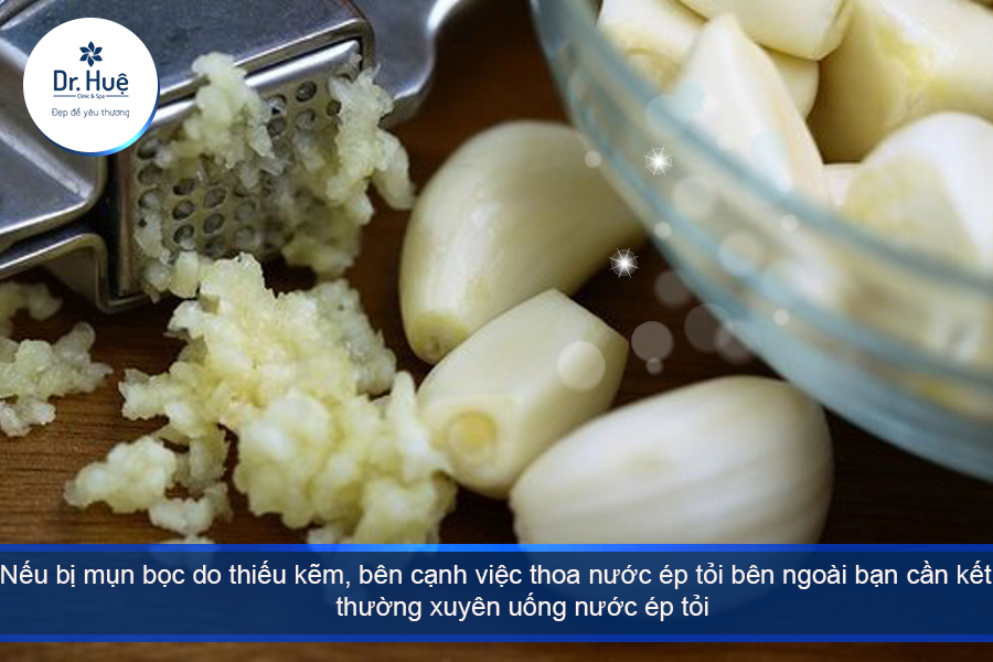 Những lưu ý khi dùng tỏi trị mụn 