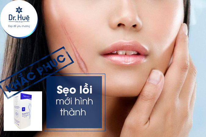 Phục hồi sẹo lồi mới hình thành 