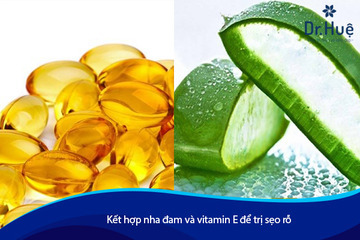 Cách Trị Sẹo Lõm Rỗ Lâu Năm Bằng Vitamin E