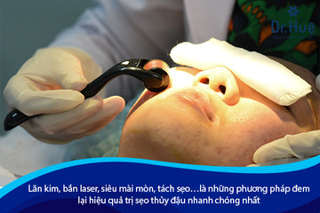 Cách Trị Sẹo Sau Khi Bị Thủy Đậu Tốt Nhất Tại Dr. Huệ