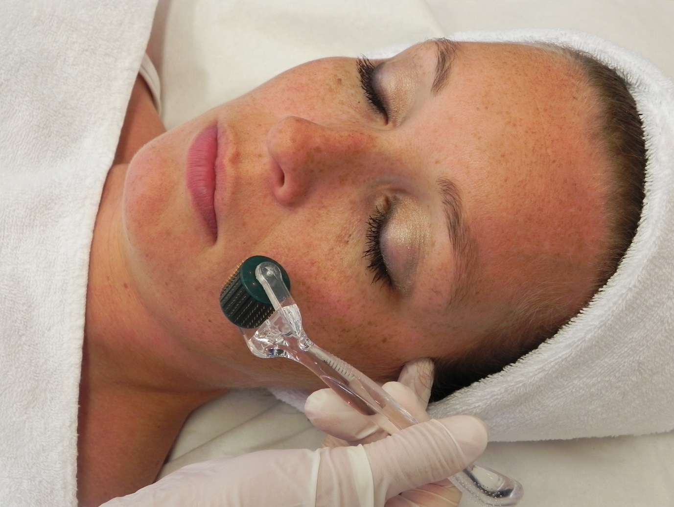 Chăm sóc da mặt sau Nano Basic như thế nào là đúng?