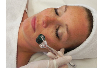 Chăm sóc da mặt sau Nano Basic như thế nào là đúng?