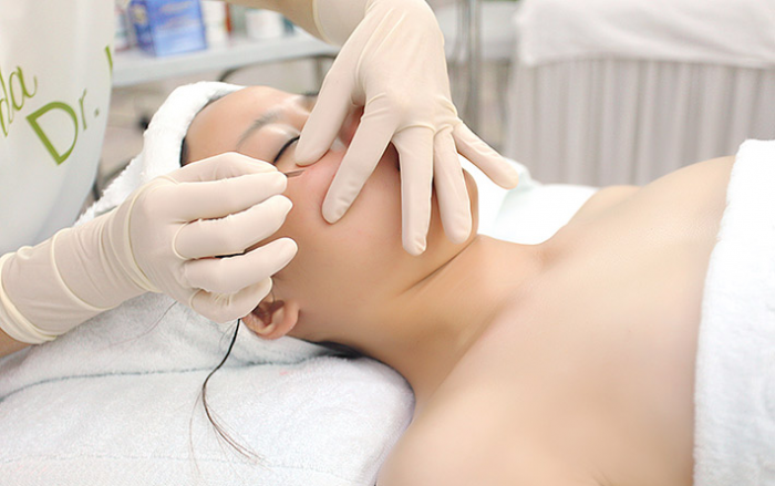 Chi phí điều trị mụn tại Dr. Huệ