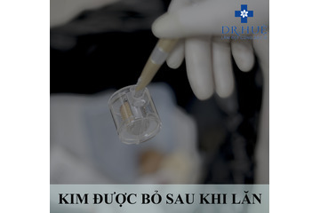 Chi tiết chi phí Nano Basic tại Trung tâm Điều trị mụn Dr.Huệ!