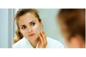 Chọn nơi điều trị sẹo rỗ uy tín và hiệu quả