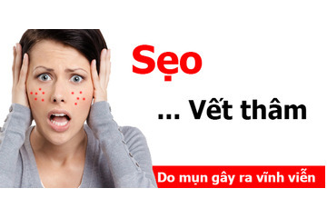 Điều trị mụn tận gốc tại đâu tốt nhất?