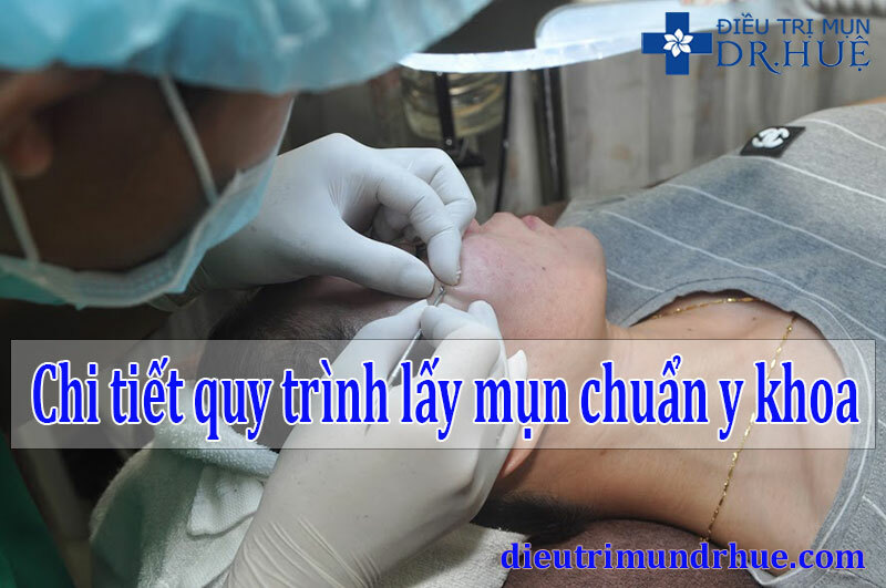Công bố chi tiết quy trình lấy mụn chuẩn y khoa