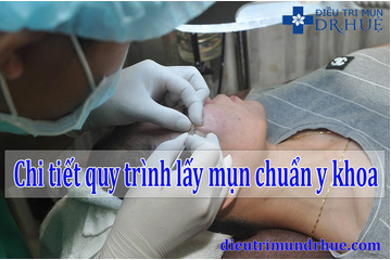 Công bố chi tiết quy trình lấy mụn chuẩn y khoa