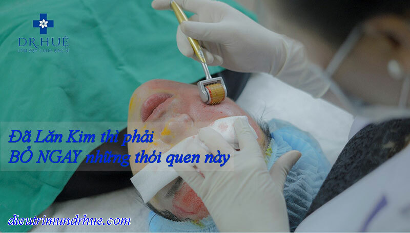Đã thực hiện Nano Basic thì phải BỎ NGAY những thói quen này