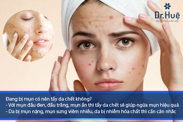 Đang Bị Mụn Có Nên Tẩy Da Chết Không?