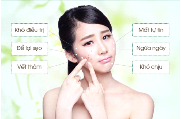 Điểm danh các loại mụn xuất hiện trên da bạn