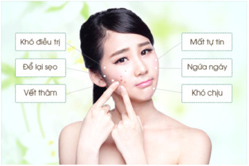 Điểm danh các loại mụn xuất hiện trên da bạn