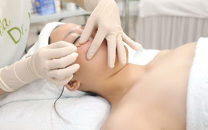 Điều trị mụn hết bao nhiêu tiền?