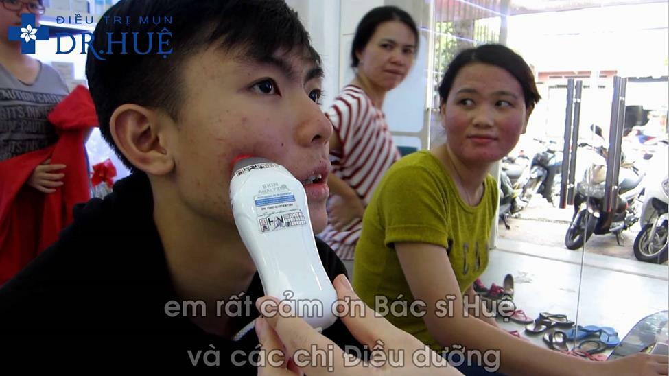 Điều trị mụn ở đâu uy tín và nhanh khỏi nhất?