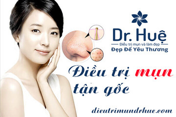 Điều trị mụn tận gốc tại điều trị mụn Dr. Huệ