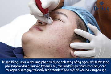 Điều Trị Sẹo Lồi Lõm Sẹo Thâm Bằng Laser Bao Nhiêu Tiền Ở Đâu TPHCM