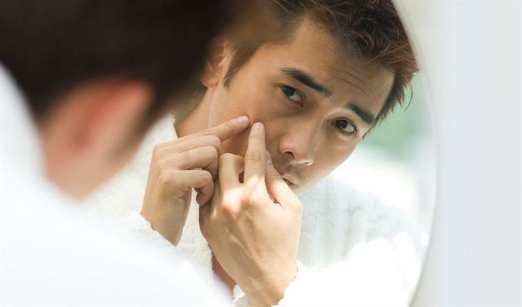 Điều trị sẹo lõm cho nam giới tại đâu? - Điều trị mụn Dr Huệ - Hình 4