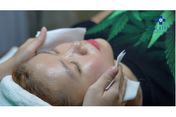 Điều trị sẹo rỗ bằng công nghệ laser là phương pháp như thế nào?