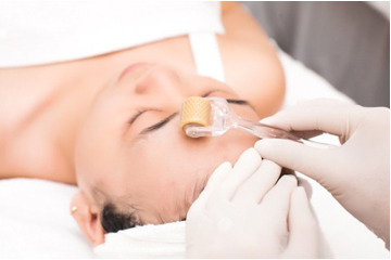 Điều trị sẹo rỗ bằng lăn kim có an toàn không?