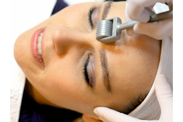 Điều trị sẹo rỗ bằng phương pháp lăn kim giúp bạn tránh khỏi biến chứng