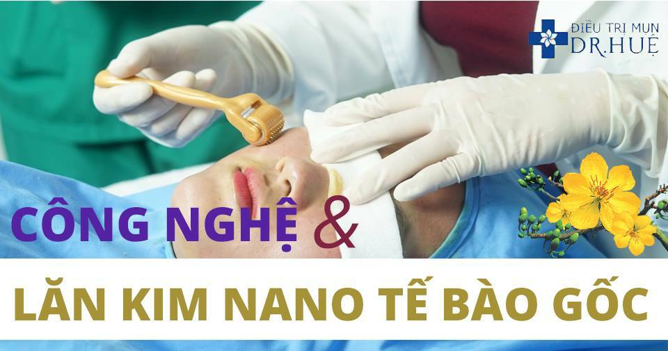 Điều trị sẹo rỗ ở đâu là tốt nhất?
